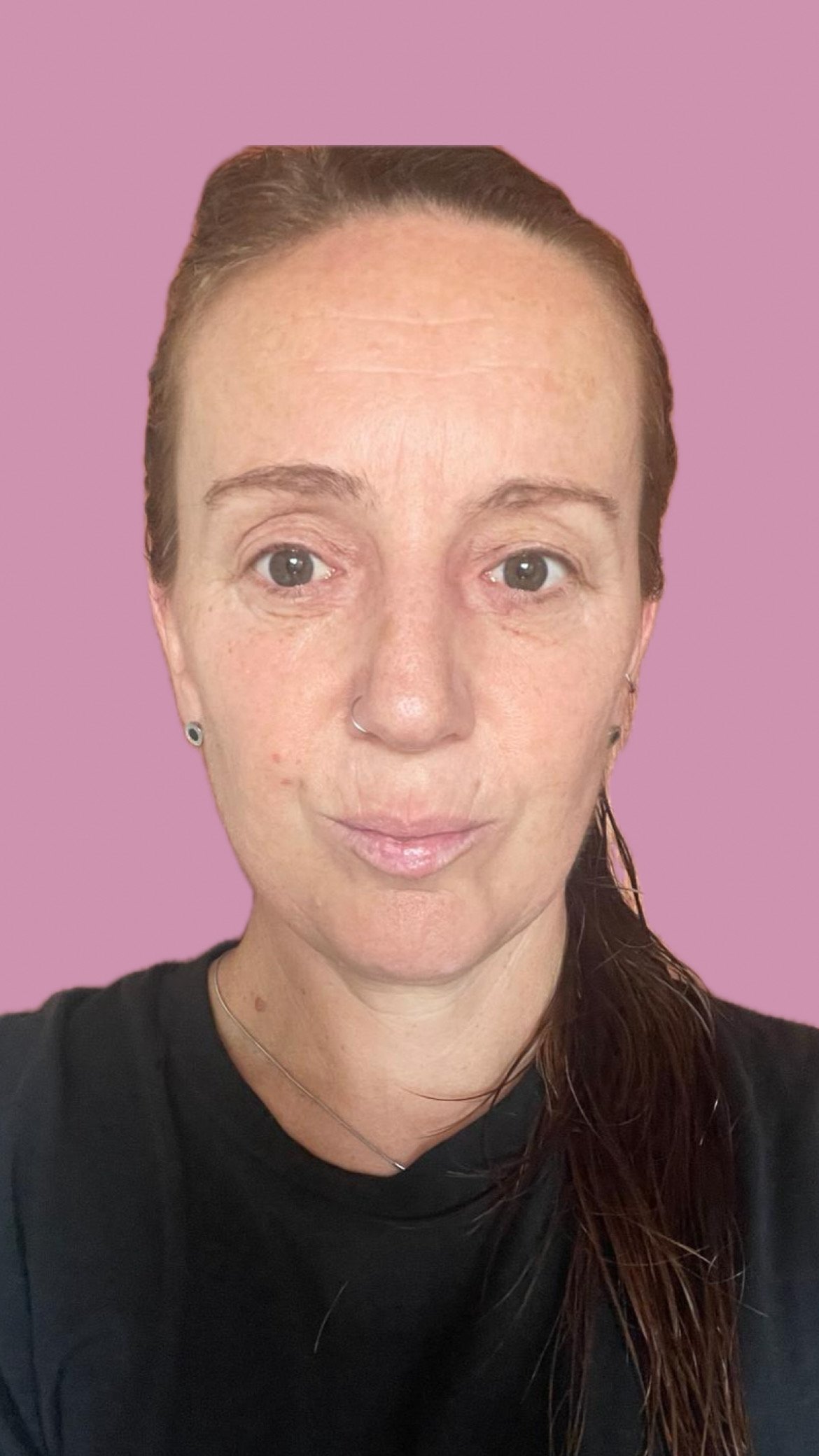 Aldana Fonoaudiologa